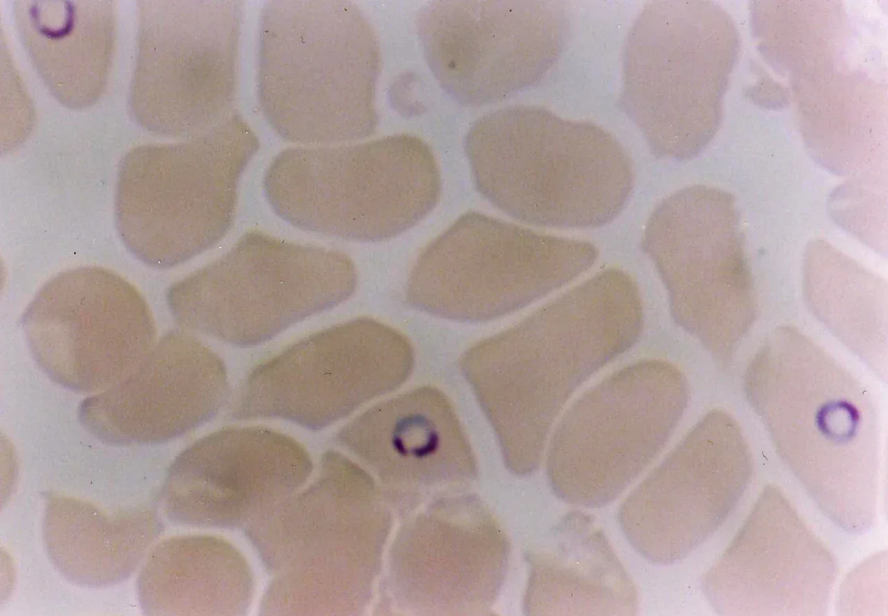 Giemsa stain చేసిన thin blood filmలో మానవ ఎర్ర రక్తకణాల లోపల Plasmodium falciparum యొక్క ring-form trophozoites కనిపిస్తున్నాయి; ప్రతి parasite మధ్యలో పలుచని భాగంతో కూడిన చిన్న ఊదా ringలా కనిపిస్తుంది.