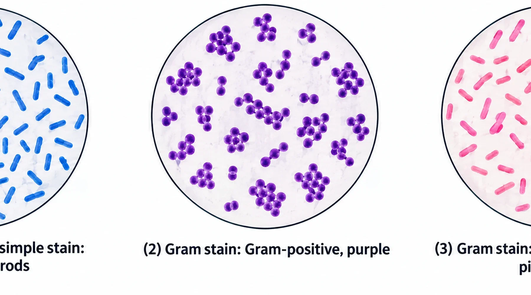 Paneles comparativos ilustrativos. Izquierda: tinción simple con azul de metileno mostrando solo bacilos azules. Centro: campo Gram positivo en morado. Derecha: campo de E. coli Gram negativo en rosa-rojo. Ilustración estilizada para comparación de métodos, no una micrografía diagnóstica.