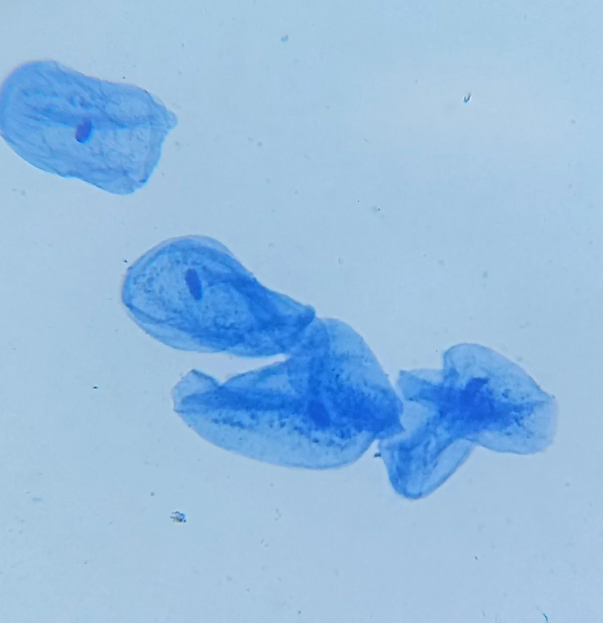 Real methylene-blue-stained cheek cells with darker nuclei and overlapping cell outlines.