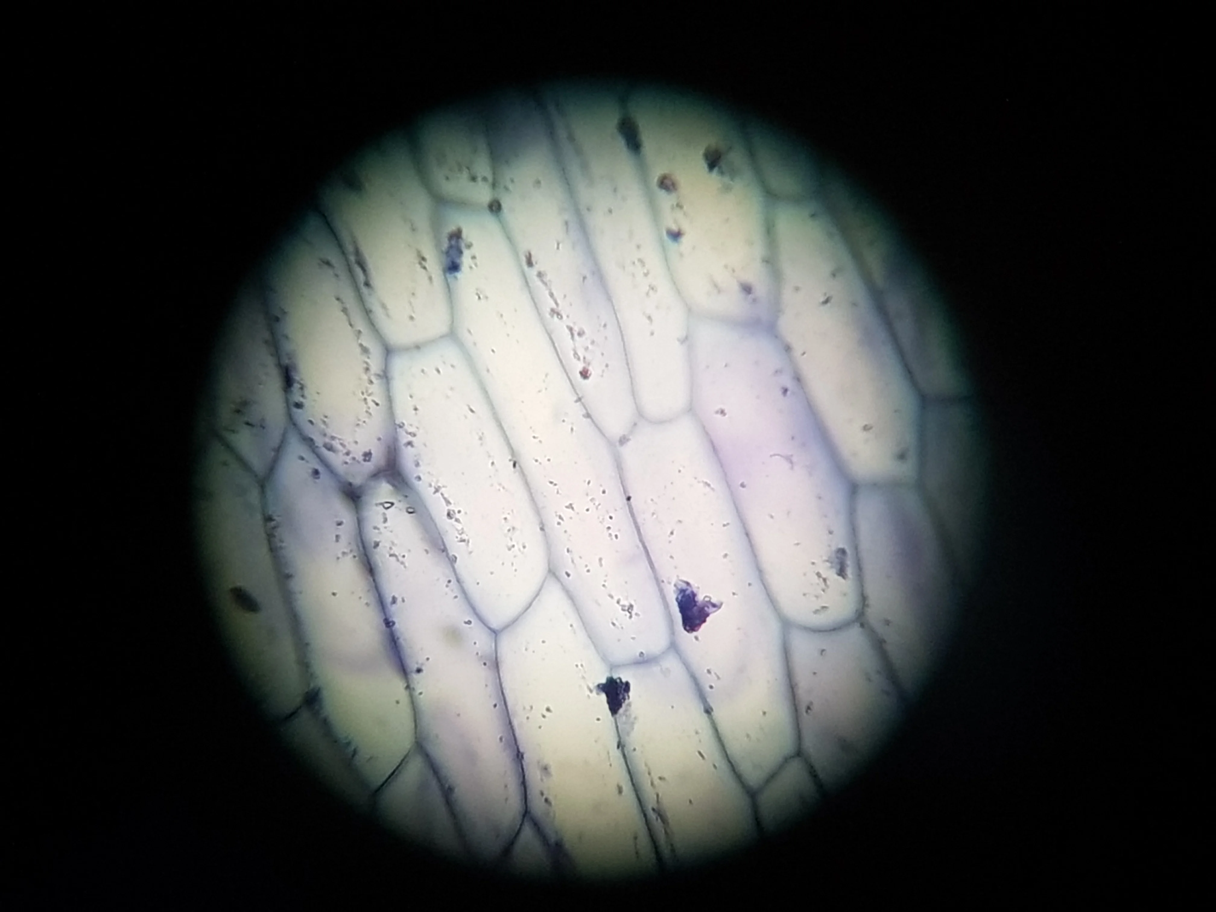 Real stained onion cells showing elongated compartments, uneven illumination, and dark particulate material.