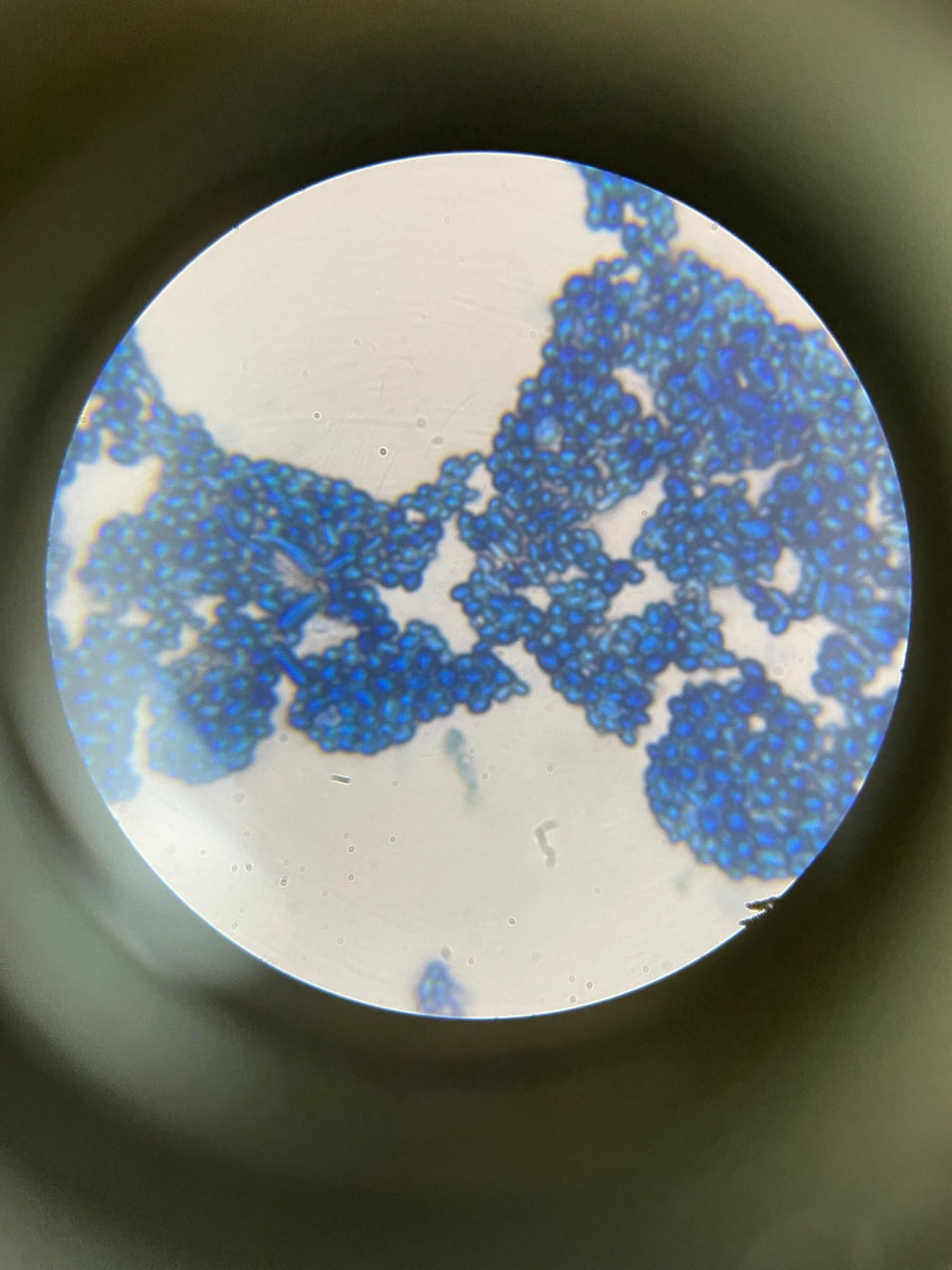 Real methylene-blue-stained yeast preparation with densely clustered oval blue objects.