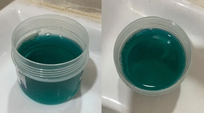 Published specimen photographs showing blue-green urine in a nonsterile container from two angles.