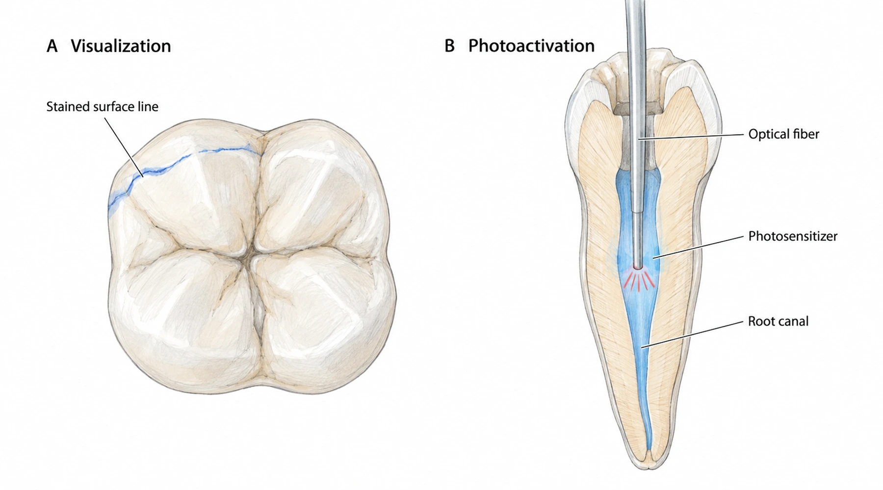 Methylene blue in dentistry: staining and photodynamic research
